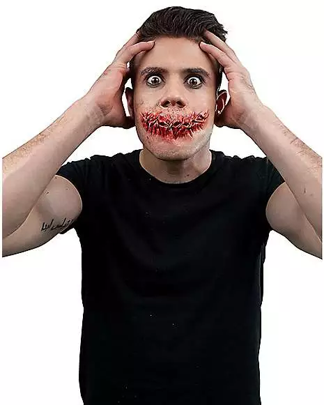 Sewn Mouth Appliance 3 Sewn Mouth Appliance